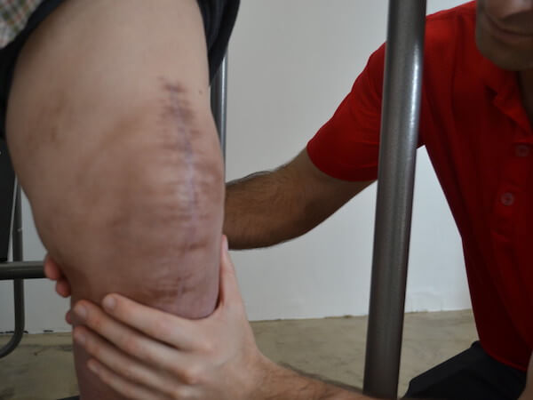 physical therapist examing someone's knee